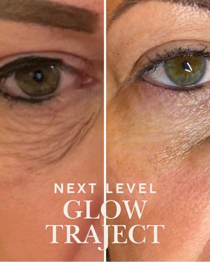Blush Next Level Glow Traject - Afbeelding 4