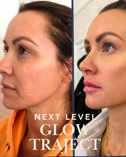 Blush Next Level Glow Traject - Afbeelding 5